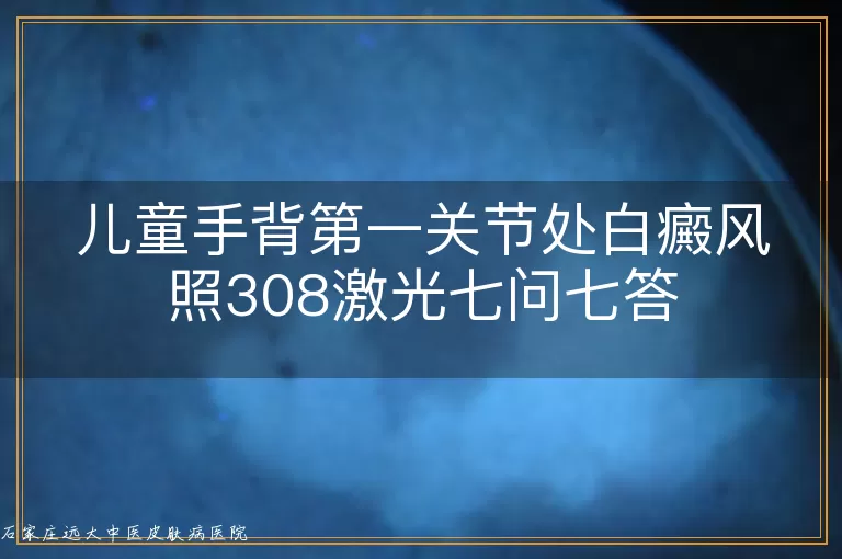 儿童手背第一关节处白癜风照308激光七问七答