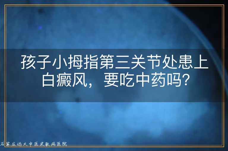 孩子小拇指第三关节处患上白癜风，要吃中药吗？
