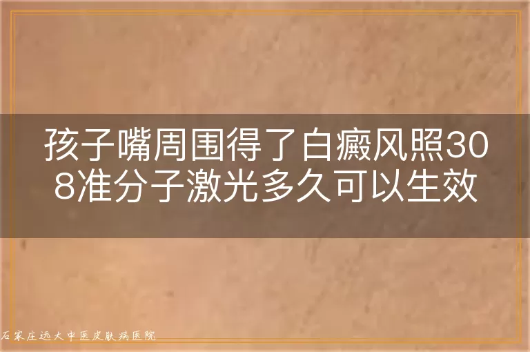孩子嘴周围得了白癜风照308准分子激光多久可以生效