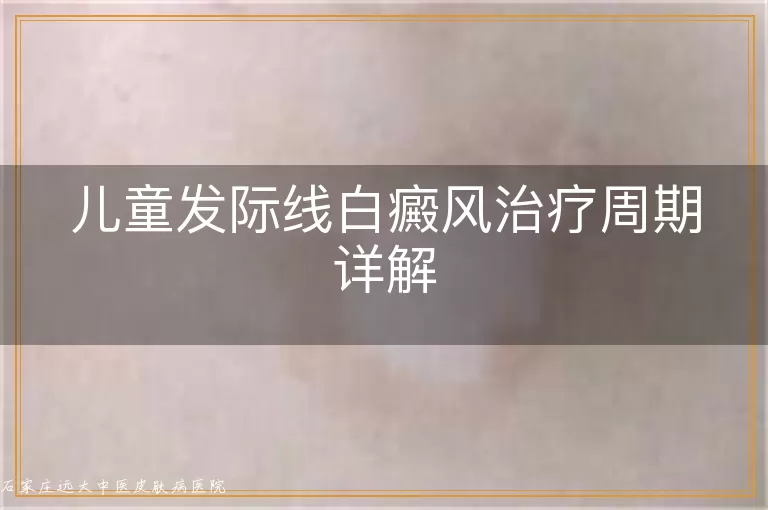 儿童发际线白癜风治疗周期详解