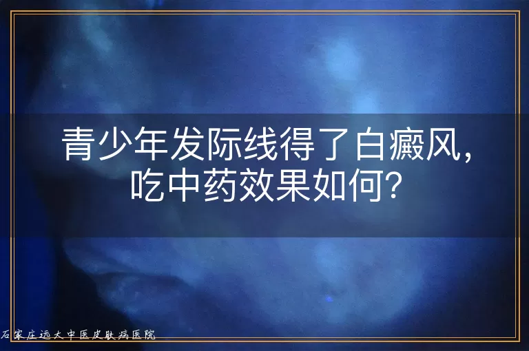 青少年发际线得了白癜风，吃中药效果如何？
