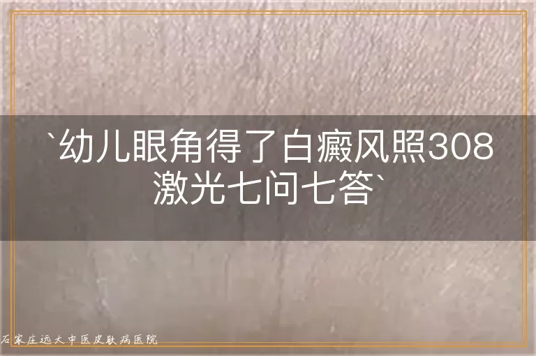 幼儿眼角得了白癜风照308激光七问七答