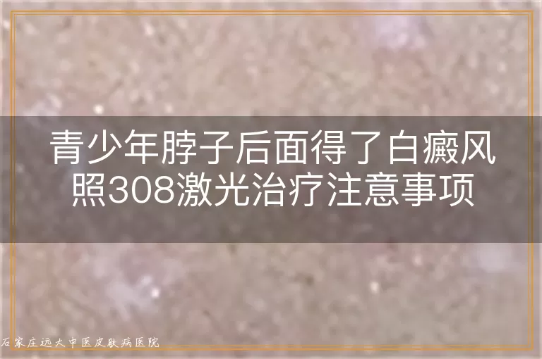 青少年脖子后面得了白癜风照308激光治疗注意事项
