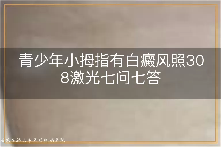 青少年小拇指有白癜风照308激光七问七答