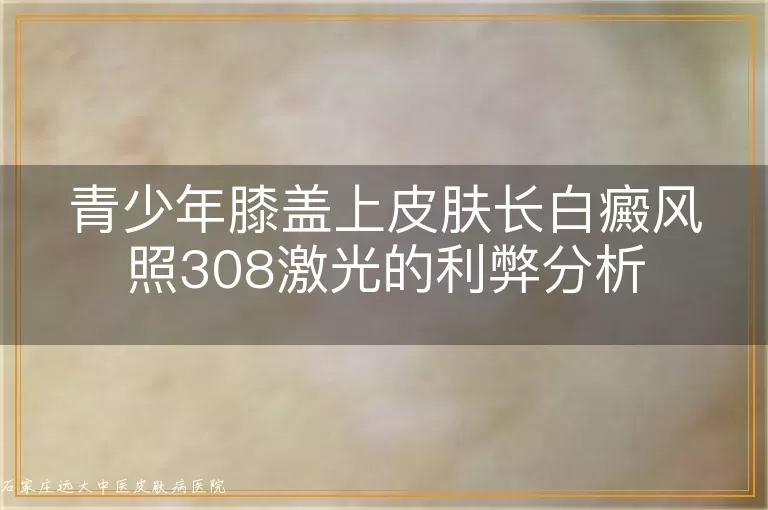 青少年膝盖上皮肤长白癜风照308激光的利弊分析