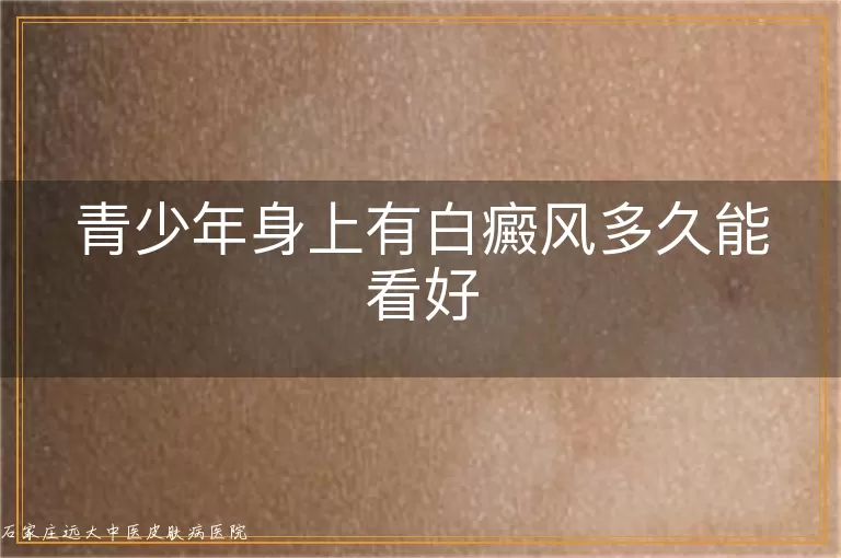 青少年身上有白癜风多久能看好