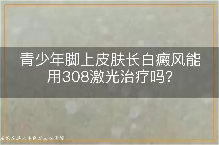 青少年脚上皮肤长白癜风能用308激光治疗吗？