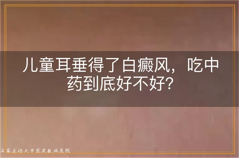 儿童耳垂得了白癜风,吃中药到底好不好?