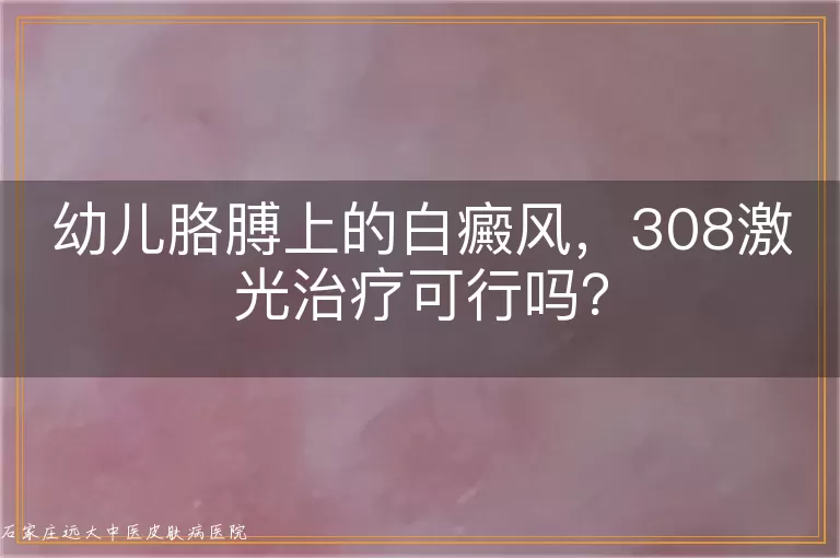 幼儿胳膊上的白癜风，308激光治疗可行吗？
