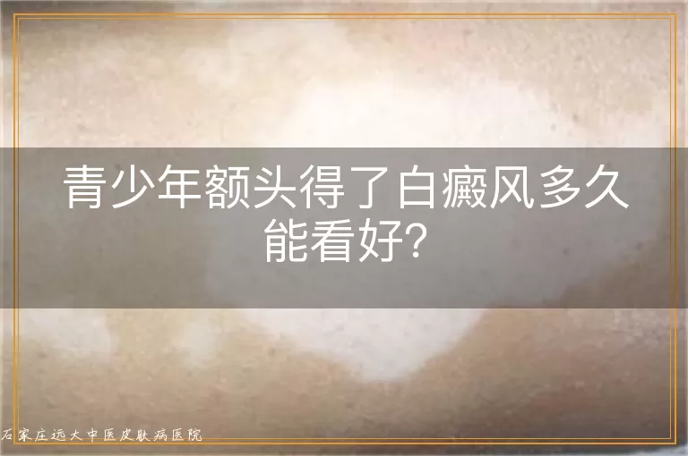青少年额头得了白癜风多久能看好?