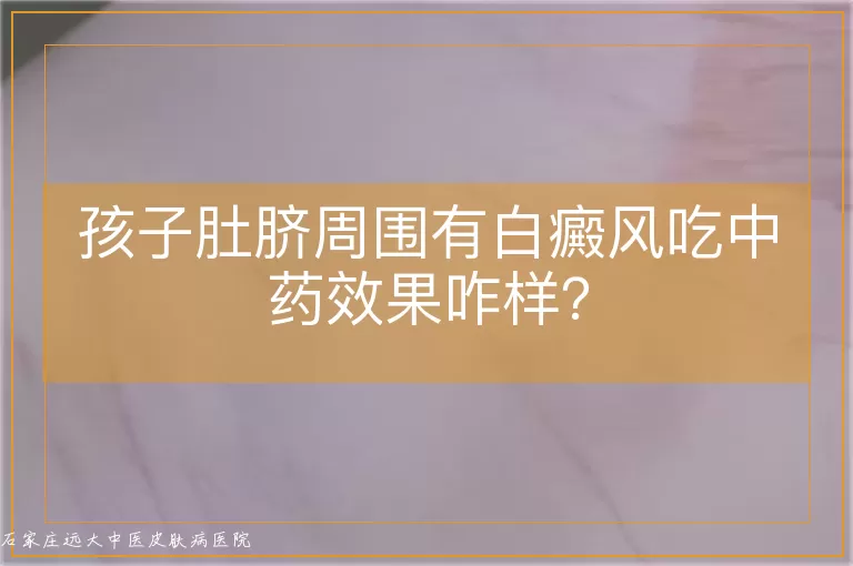 孩子肚脐周围有白癜风吃中药效果咋样?