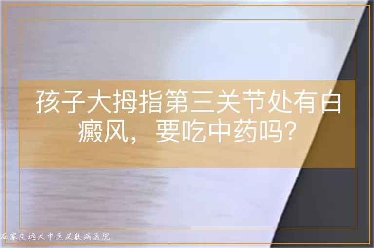 孩子大拇指第三关节处有白癜风，要吃中药吗？