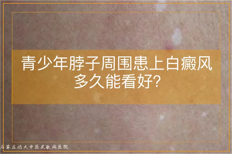 青少年脖子周围患上白癜风多久能看好?