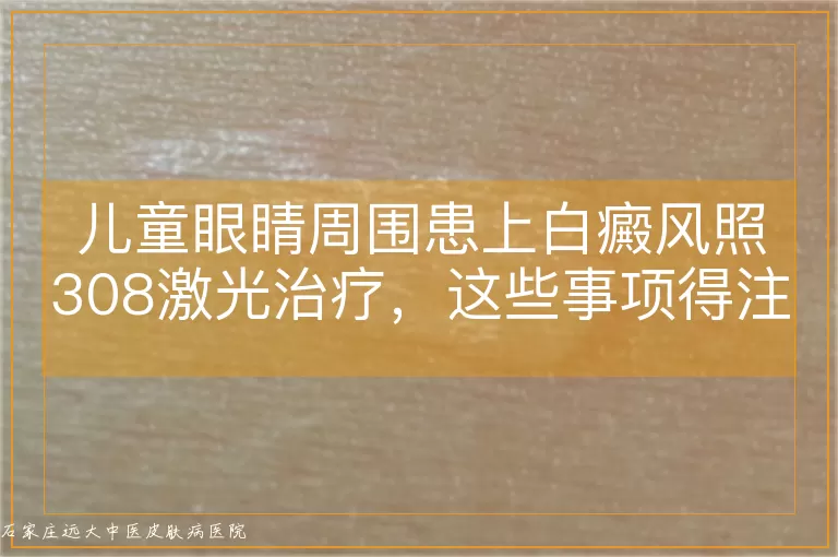 儿童眼睛周围患上白癜风照308激光治疗，这些事项得注意！