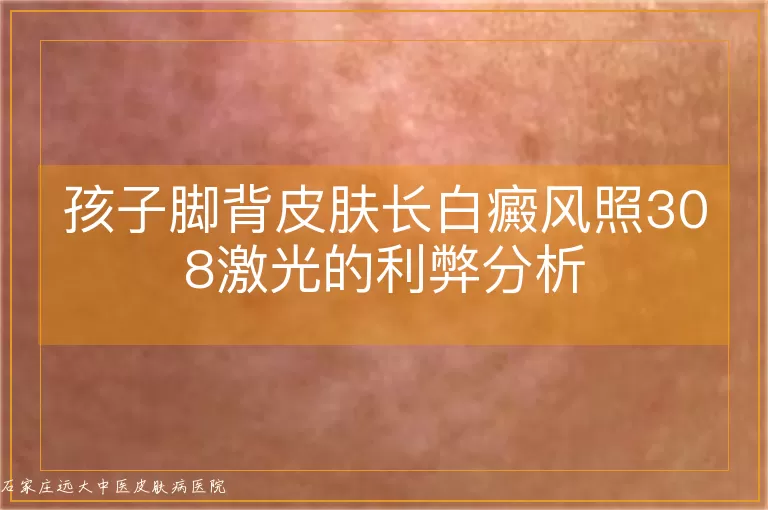孩子脚背皮肤长白癜风照308激光的利弊分析