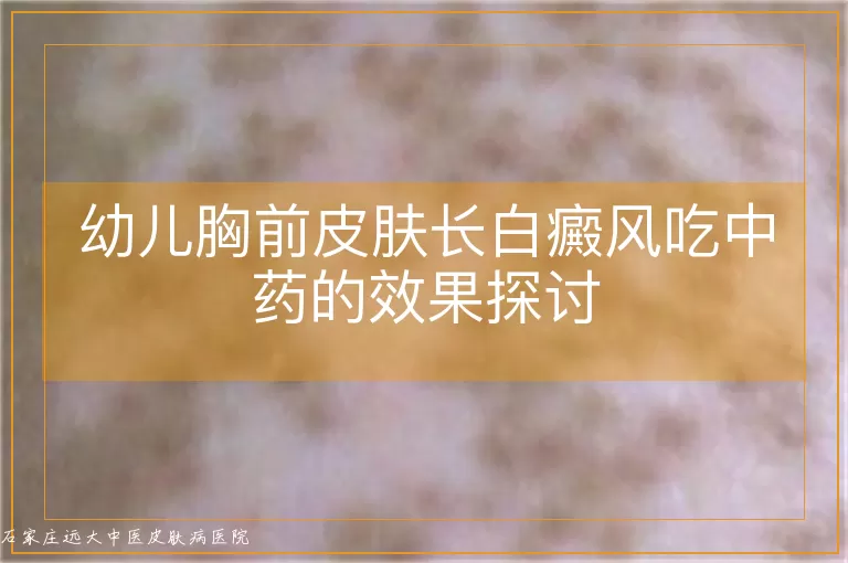 幼儿胸前皮肤长白癜风吃中药的效果探讨