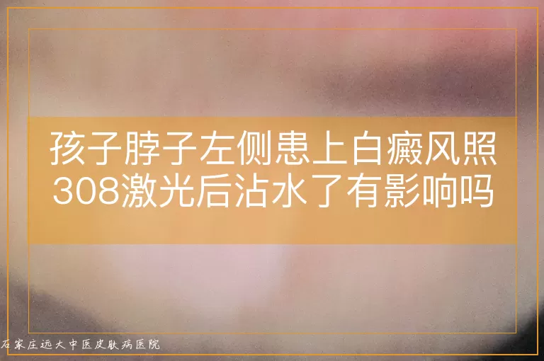 孩子脖子左侧患上白癜风照308激光后沾水了有影响吗
