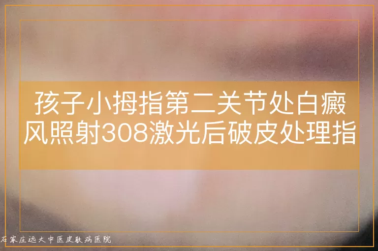 孩子小拇指第二关节处白癜风照射308激光后破皮处理指南