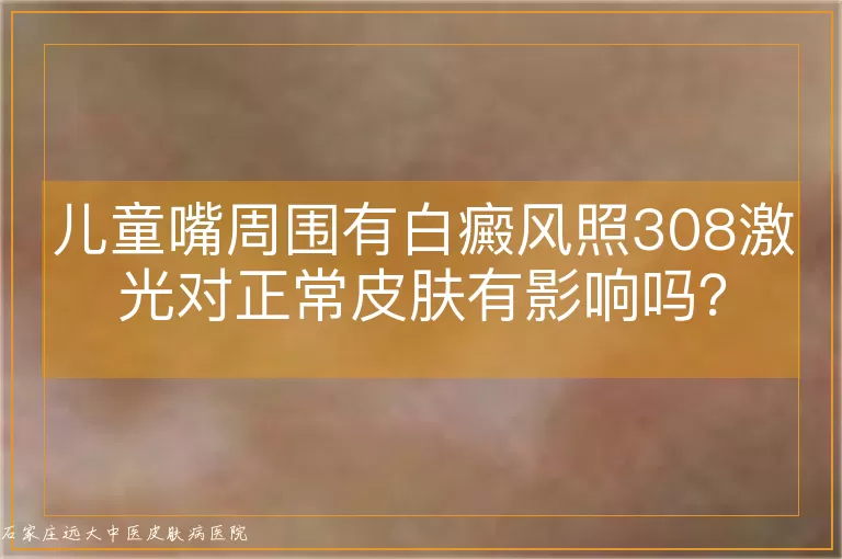 儿童嘴周围有白癜风照308激光对正常皮肤有影响吗？