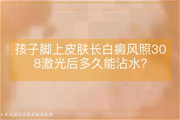 孩子脚上皮肤长白癜风照308激光后多久能沾水？