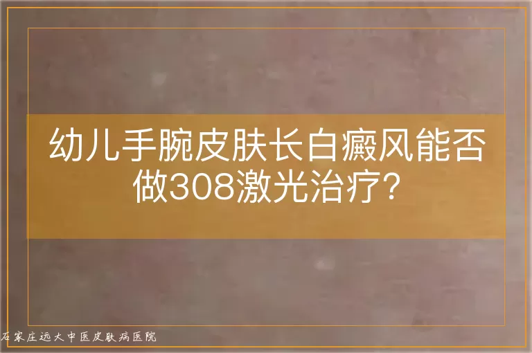 幼儿手腕皮肤长白癜风能否做308激光治疗？
