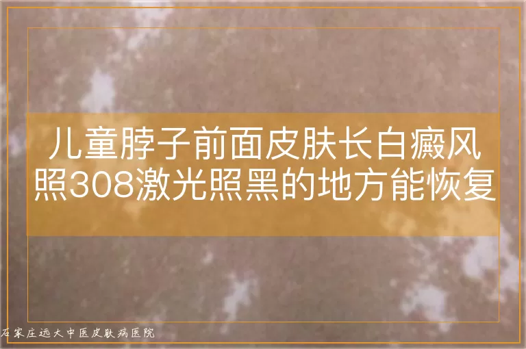 儿童脖子前面皮肤长白癜风照308激光照黑的地方能恢复吗