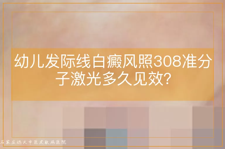 幼儿发际线白癜风照308准分子激光多久见效？