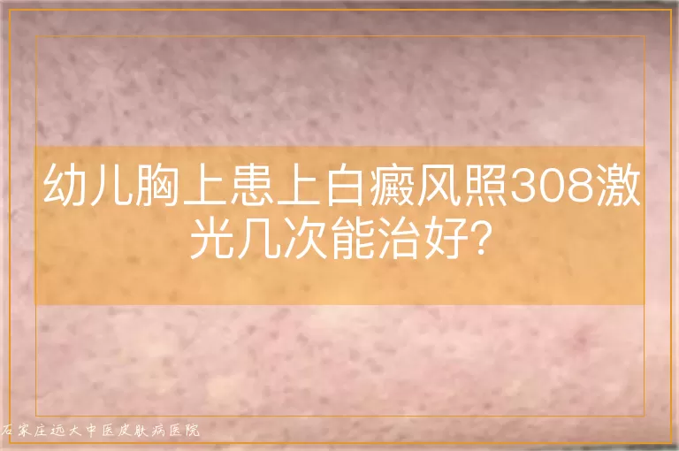 幼儿胸上患上白癜风照308激光几次能治好？