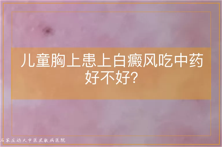 儿童胸上患上白癜风吃中药好不好？