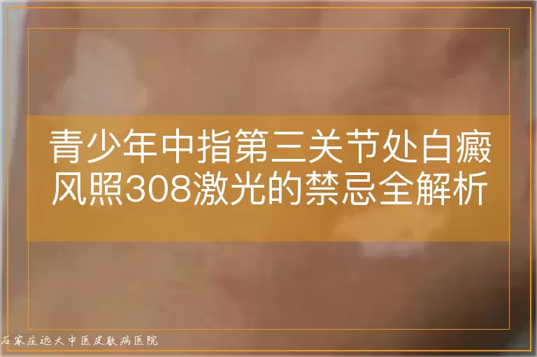 青少年中指第三关节处白癜风照308激光的禁忌全解析