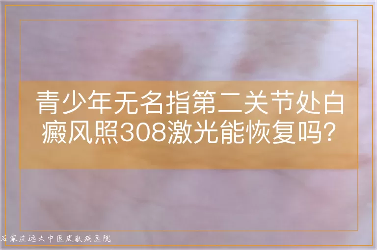 青少年无名指第二关节处白癜风照308激光能恢复吗？