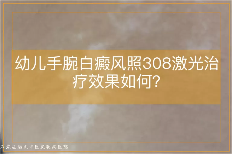 幼儿手腕白癜风照308激光治疗效果如何？