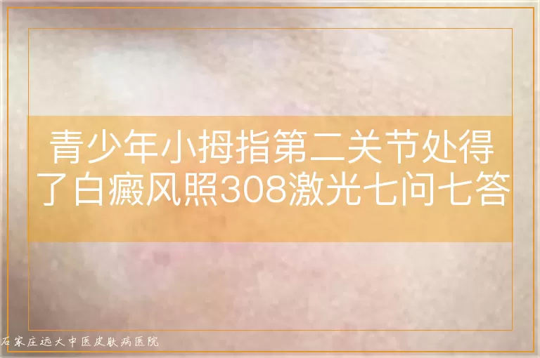 青少年小拇指第二关节处得了白癜风照308激光七问七答