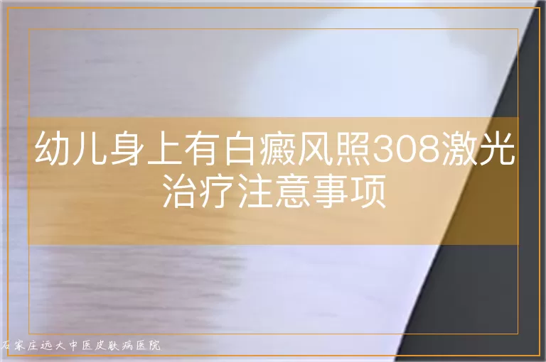幼儿身上有白癜风照308激光治疗注意事项