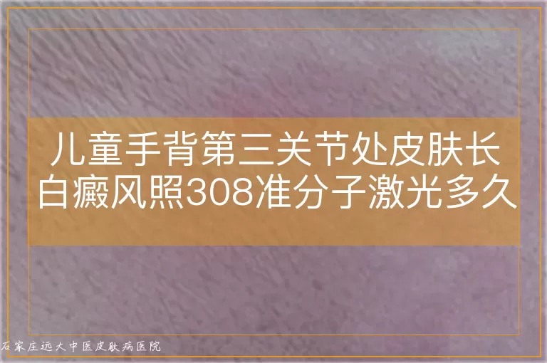 儿童手背第三关节处皮肤长白癜风照308准分子激光多久见效