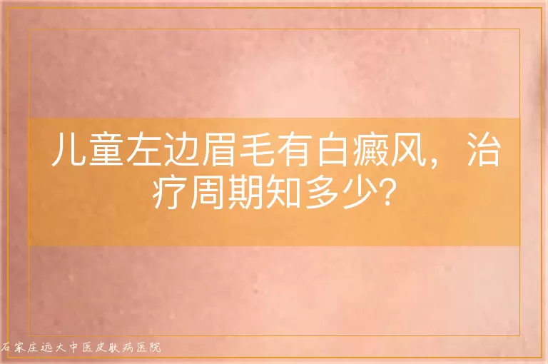 儿童左边眉毛有白癜风，治疗周期知多少？