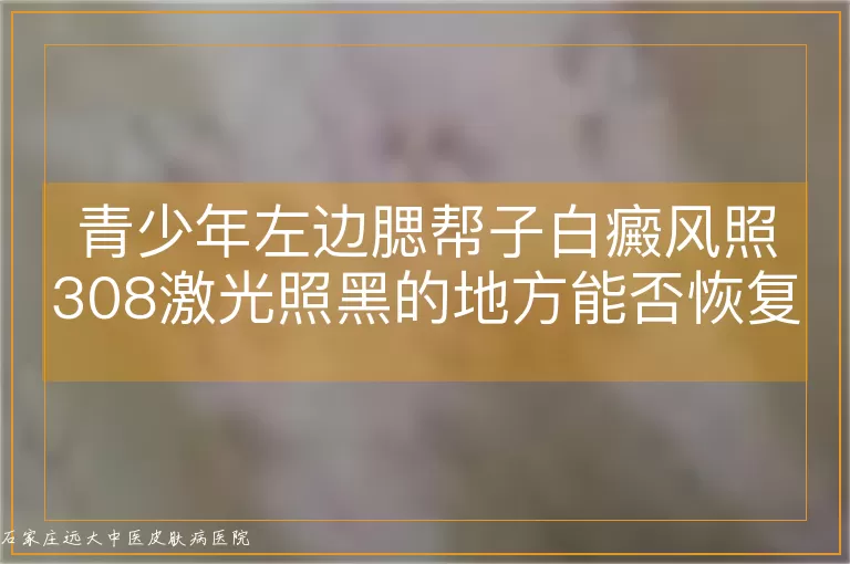 青少年左边腮帮子白癜风照308激光照黑的地方能否恢复？