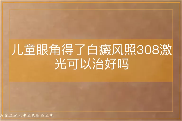 儿童眼角得了白癜风照308激光可以治好吗