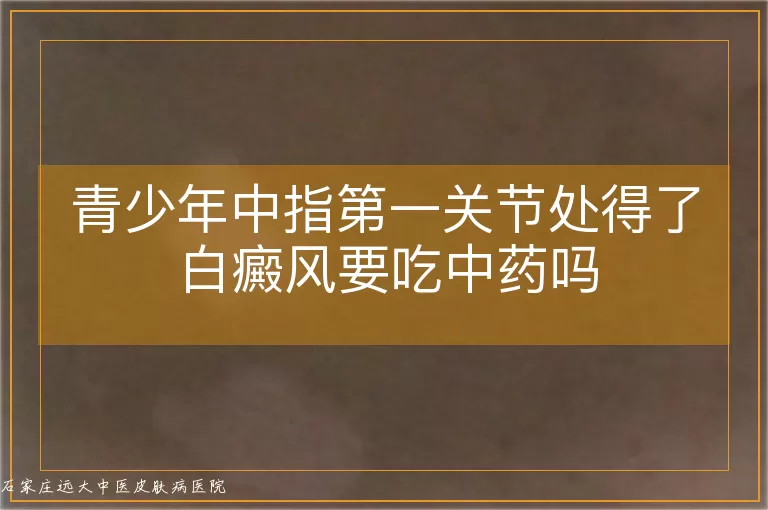 青少年中指第一关节处得了白癜风要吃中药吗