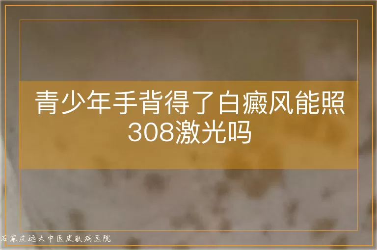 青少年手背得了白癜风能照308激光吗