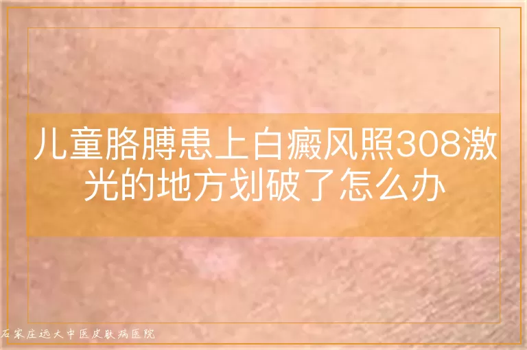 儿童胳膊患上白癜风照308激光的地方划破了怎么办