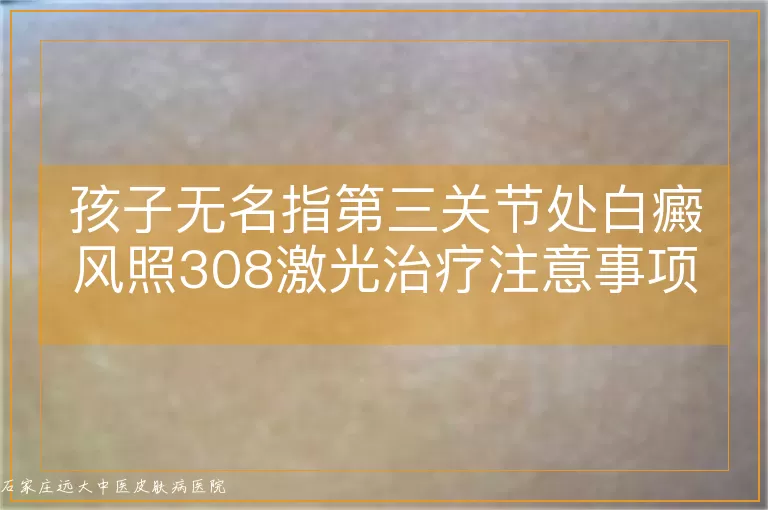 孩子无名指第三关节处白癜风照308激光治疗注意事项