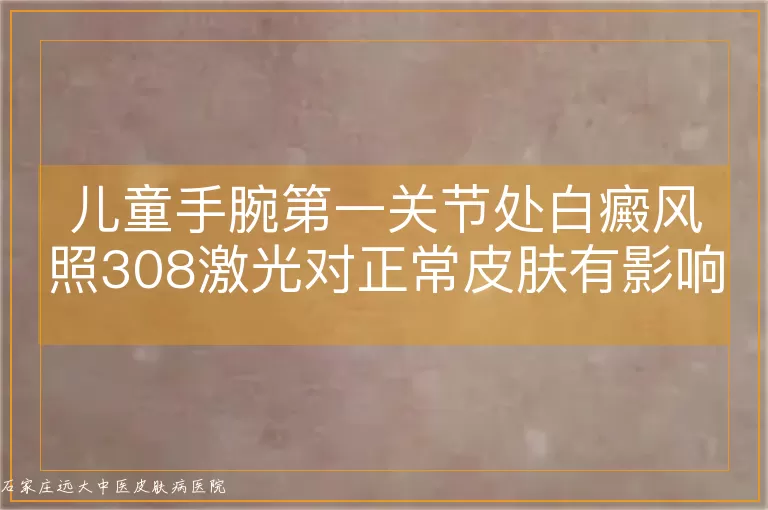 儿童手腕第一关节处白癜风照308激光对正常皮肤有影响吗？