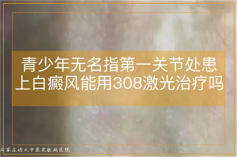 青少年无名指第一关节处患上白癜风能用308激光治疗吗？