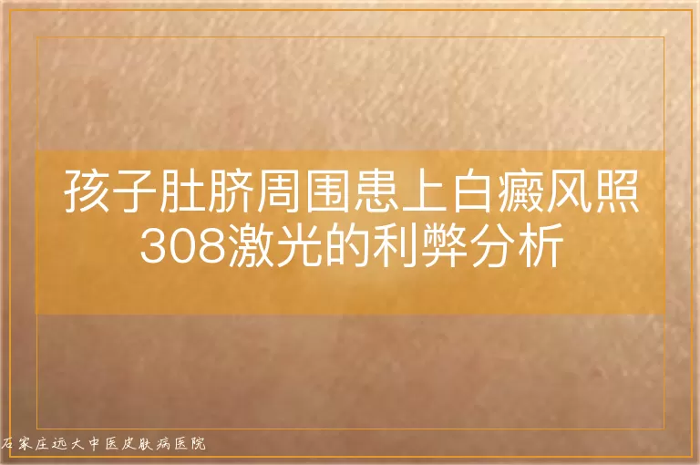 孩子肚脐周围患上白癜风照308激光的利弊分析