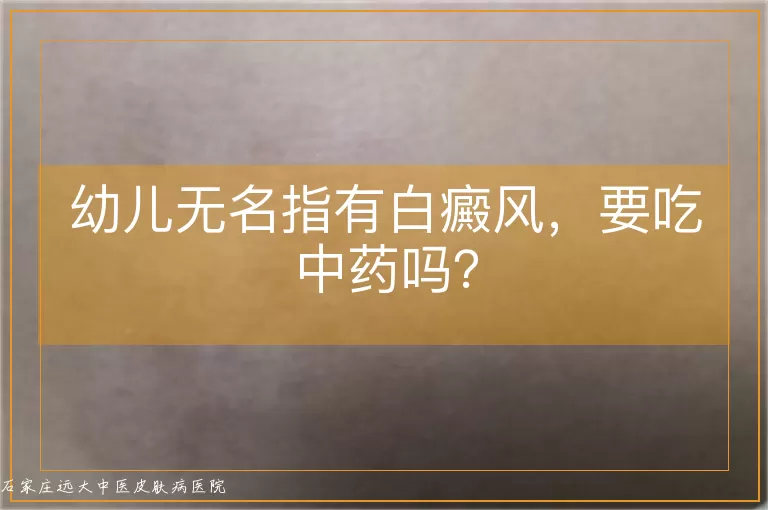 幼儿无名指有白癜风，要吃中药吗？