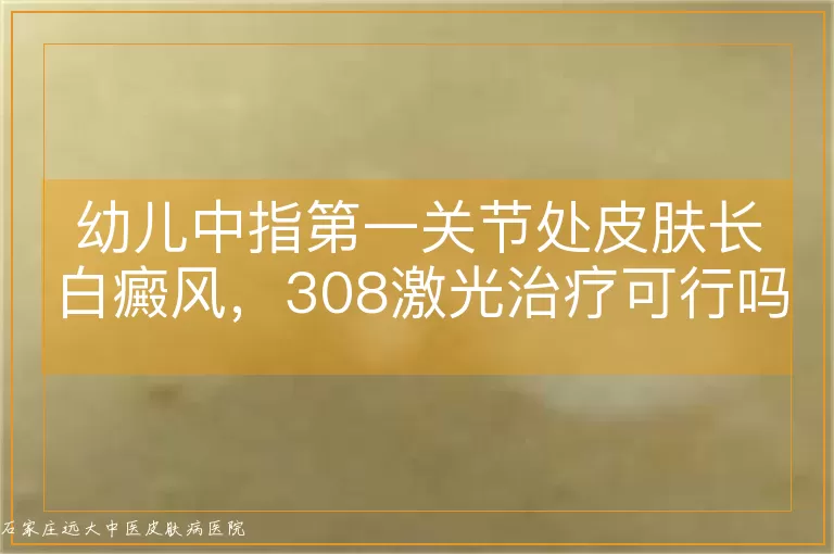 幼儿中指第一关节处皮肤长白癜风，308激光治疗可行吗？