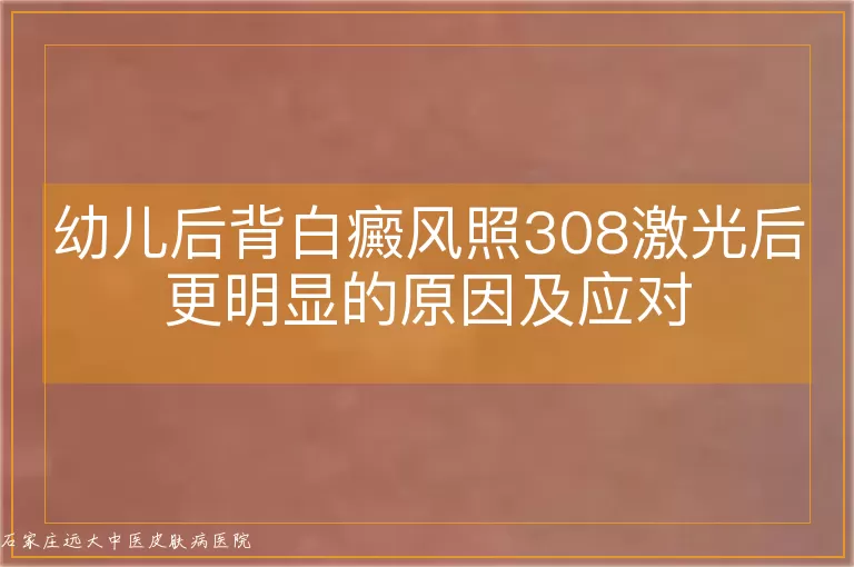 幼儿后背白癜风照308激光后更明显的原因及应对
