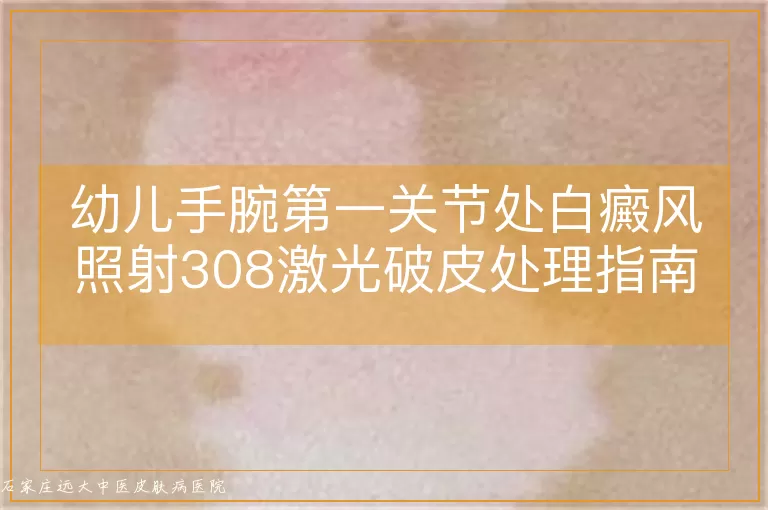幼儿手腕第一关节处白癜风照射308激光破皮处理指南