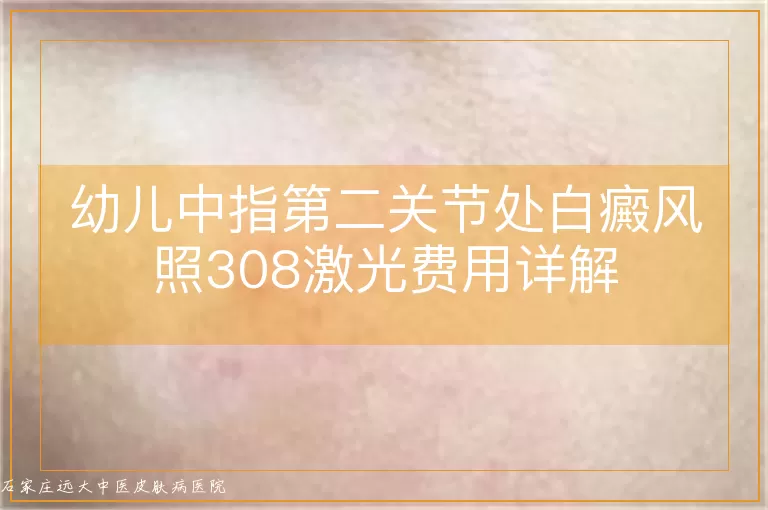 幼儿中指第二关节处白癜风照308激光费用详解